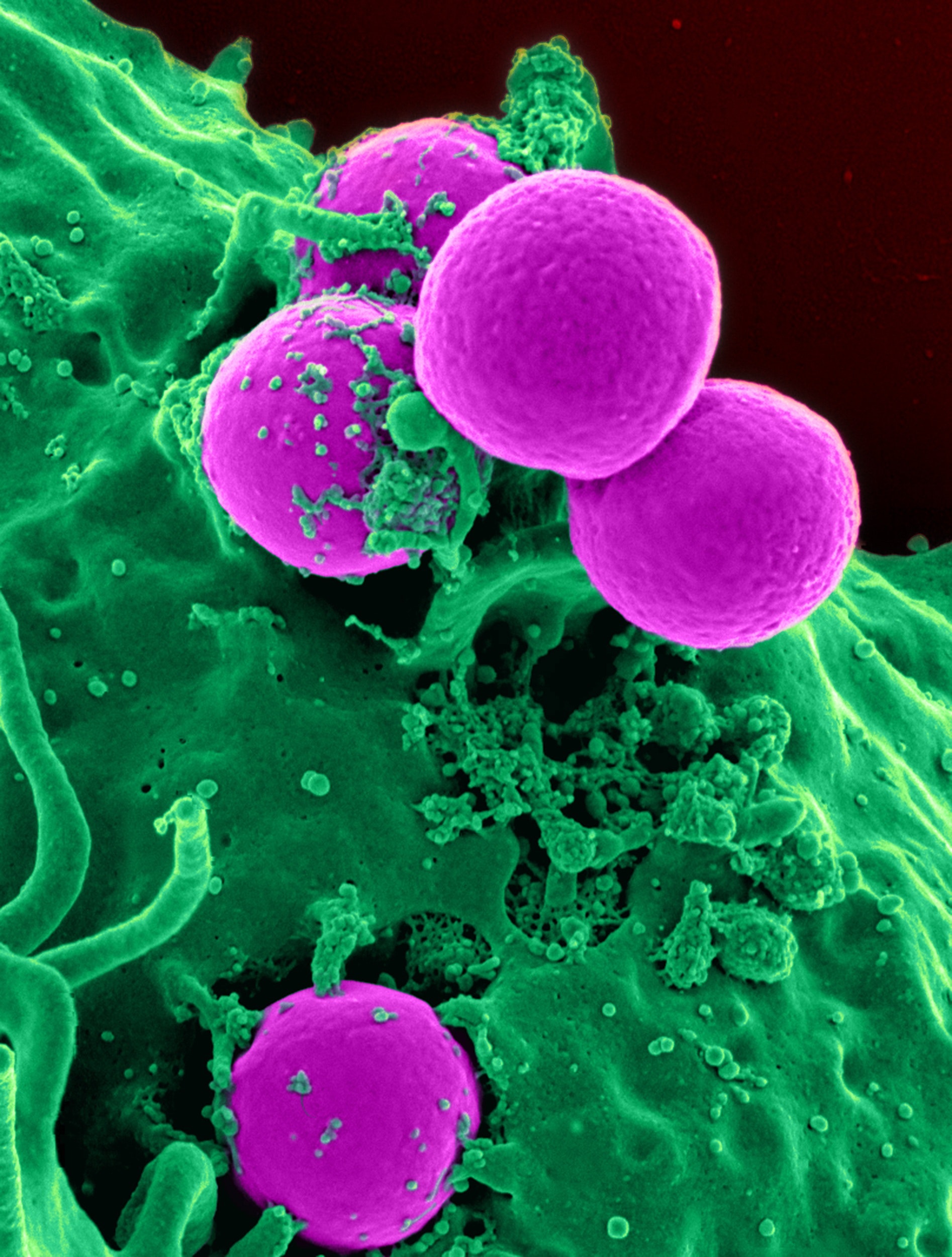 Coloured image of bacteria